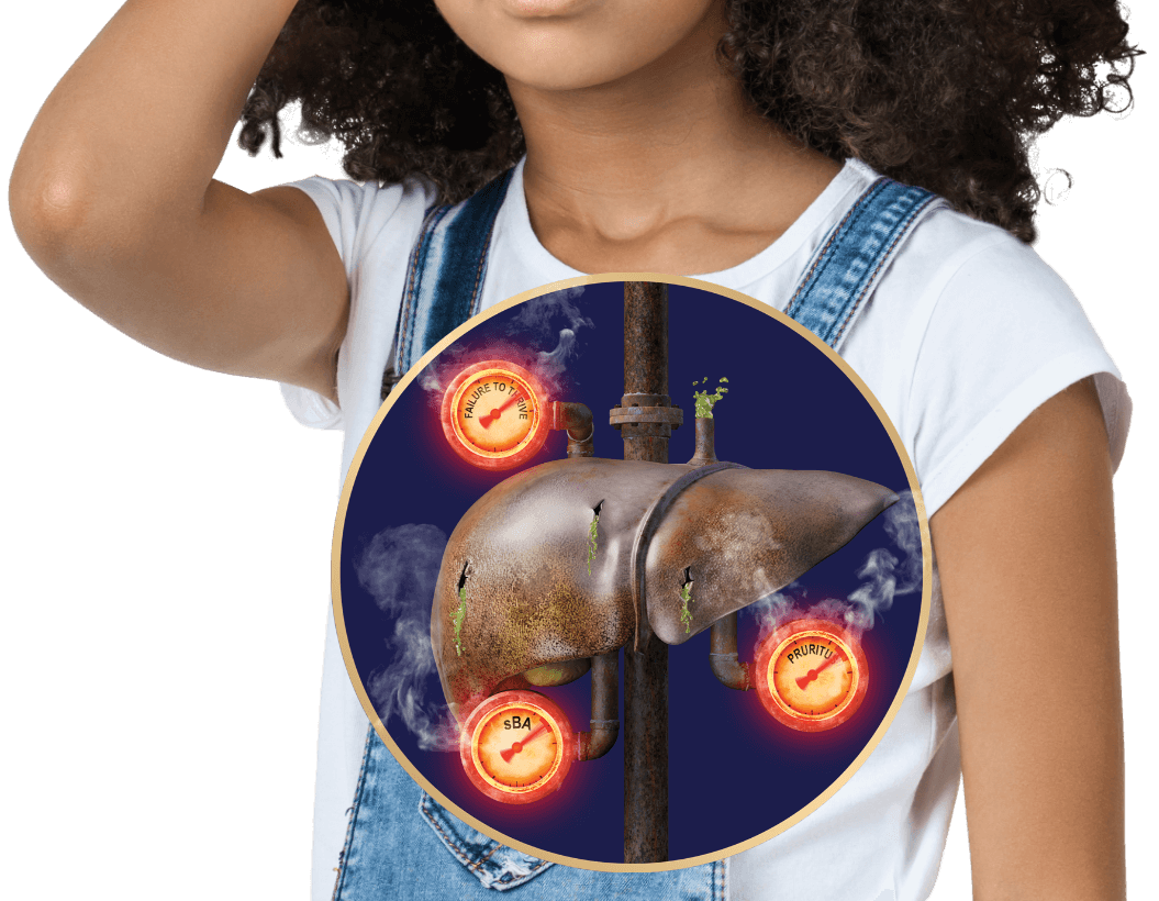 A circle window showing a liver with spilling bile surrounded by 3 glowing red gauges on the stomach of a young girl wearing overalls